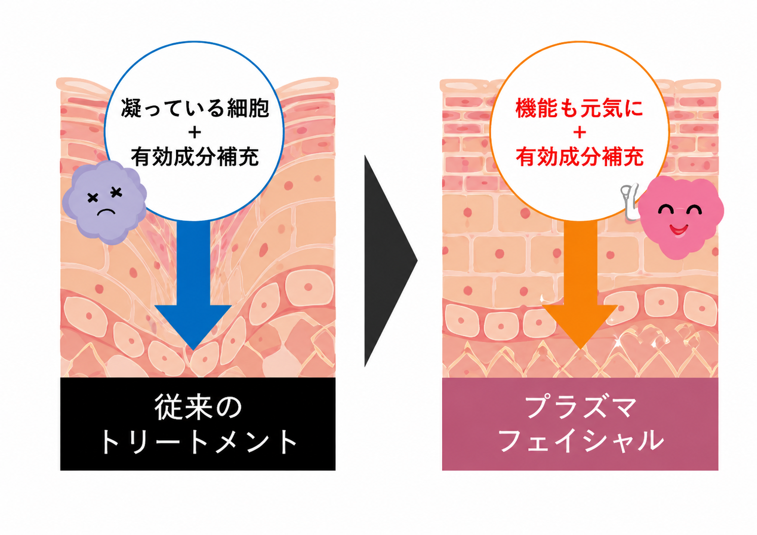 従来のトリートメントとプラズマフェイシャルの比較イメージ